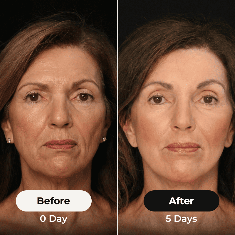 FaceSculpt™ Brush