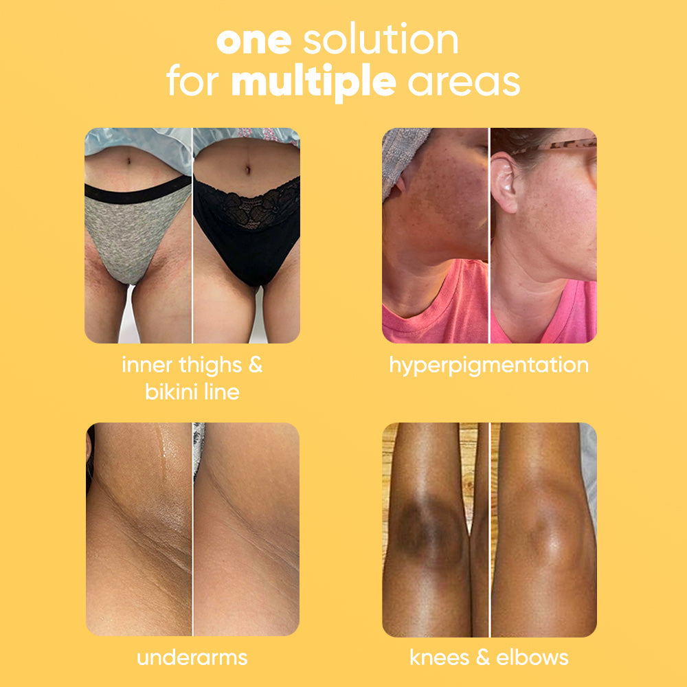 GlowBar™ Kojic & Turmeric Bar