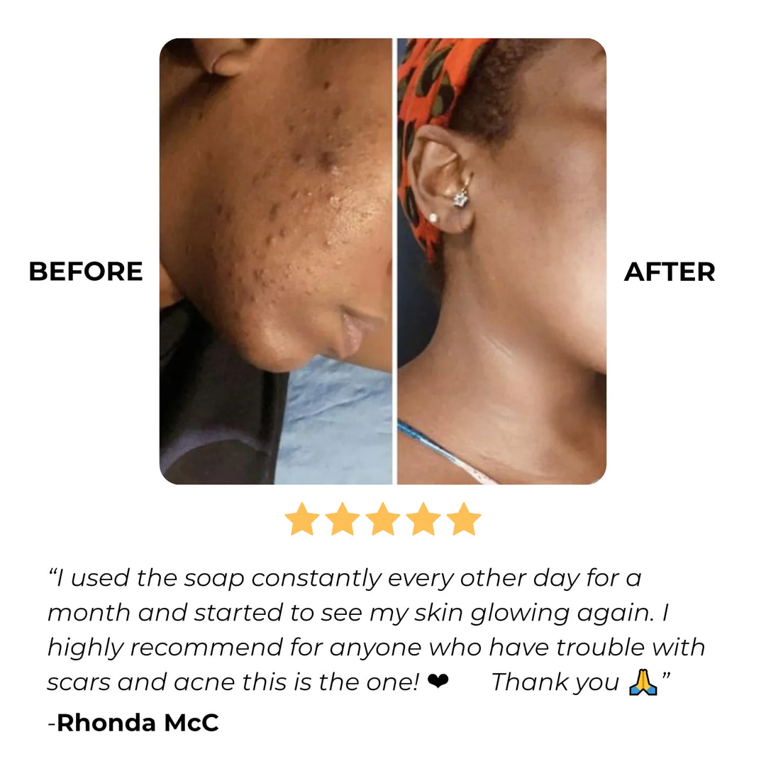 GlowBar™ Kojic & Turmeric Bar