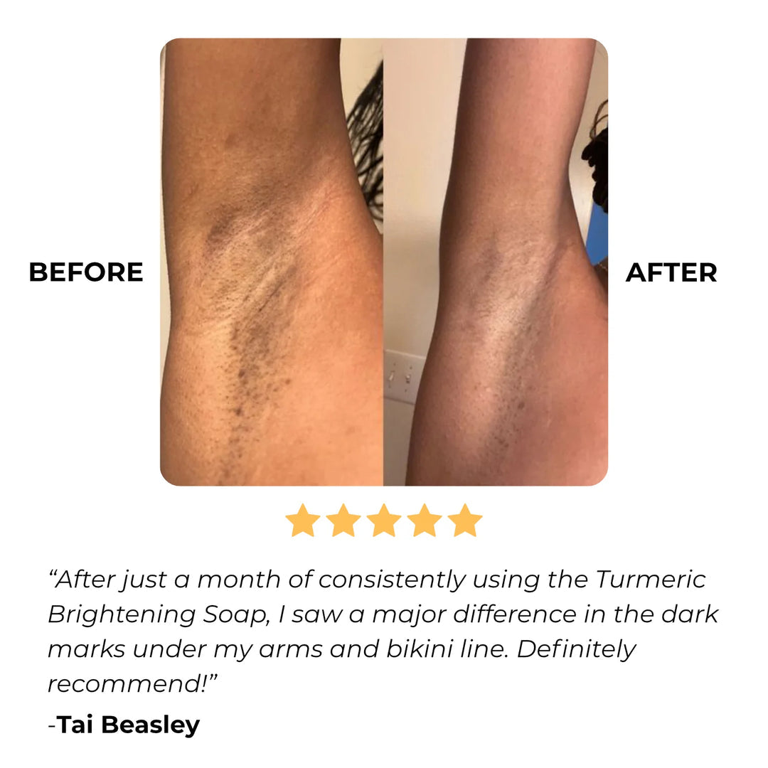 GlowBar™ Kojic & Turmeric Bar