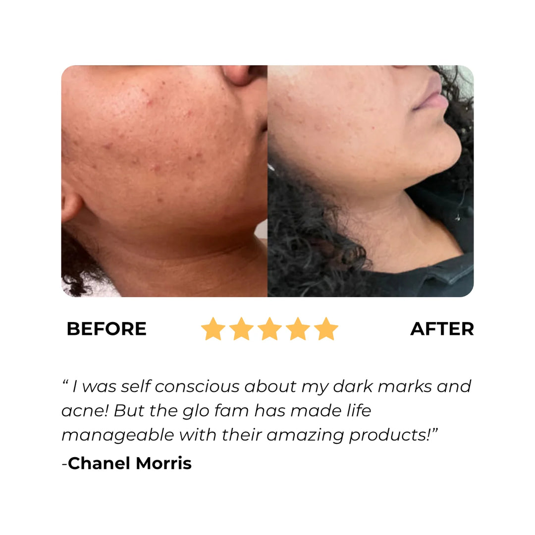 GlowBar™ Kojic & Turmeric Bar
